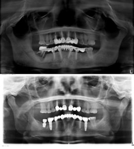  Невская стоматология имплантология